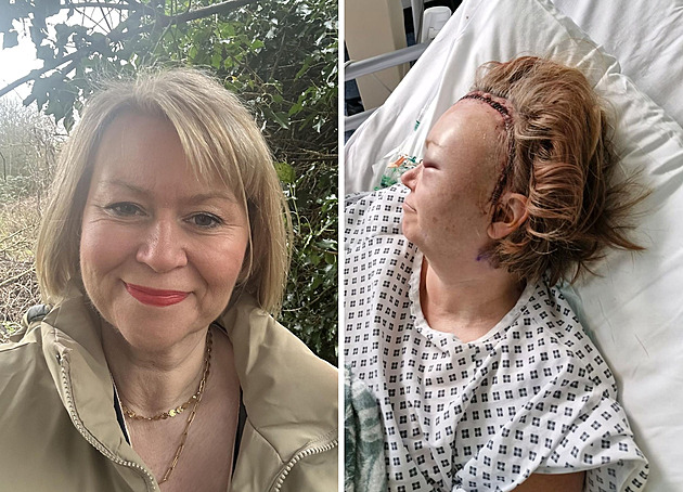 Najednou se sesunula a bojovala o život, na vině bylo prasklé aneurysma